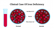 Best  Clinical Case Of Iron Deficiency Google Slides