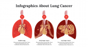 Infographics About Lung Cancer For Medical Presentation
