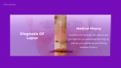 300374-World-Lupus-Day-Presentation_06