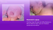 300374-World-Lupus-Day-Presentation_13