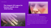 300374-World-Lupus-Day-Presentation_23