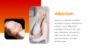 300396-International-Albinism-Awareness-Day_04
