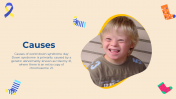 703571-Down-Syndrome-PowerPoint-Slides_10