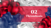 704815-World-Thrombosis-Disease-Day_09