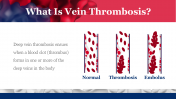 704815-World-Thrombosis-Disease-Day_12