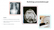 Free Radiology Presentation PPT Template & Google Slides