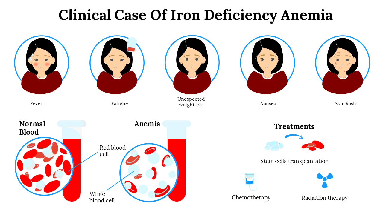 Clinical Case Of Iron Deficiency Anemia Google Slides