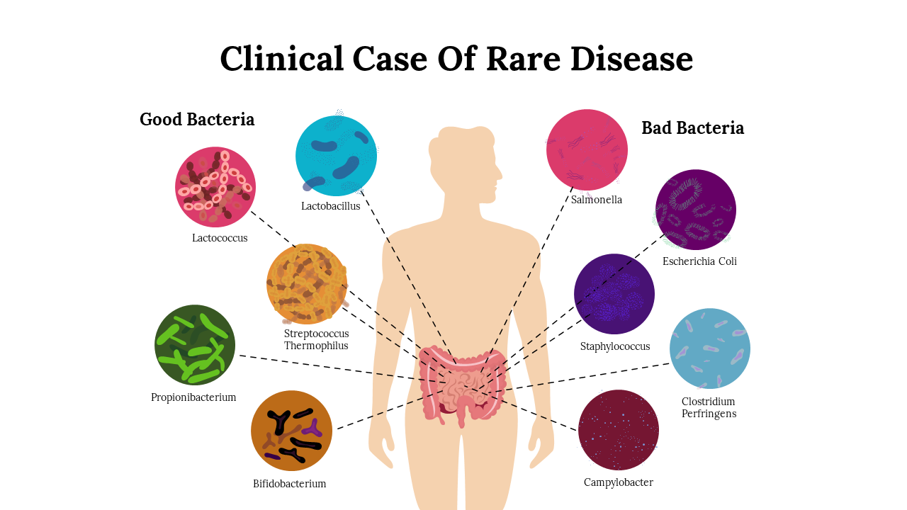 Clinical Case Of Rare Disease
