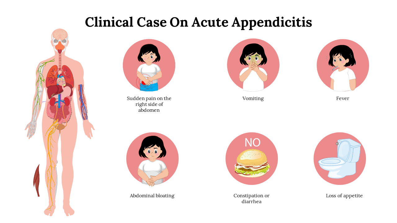 Creative Clinical Case On Acute Appendicitis Google Slides