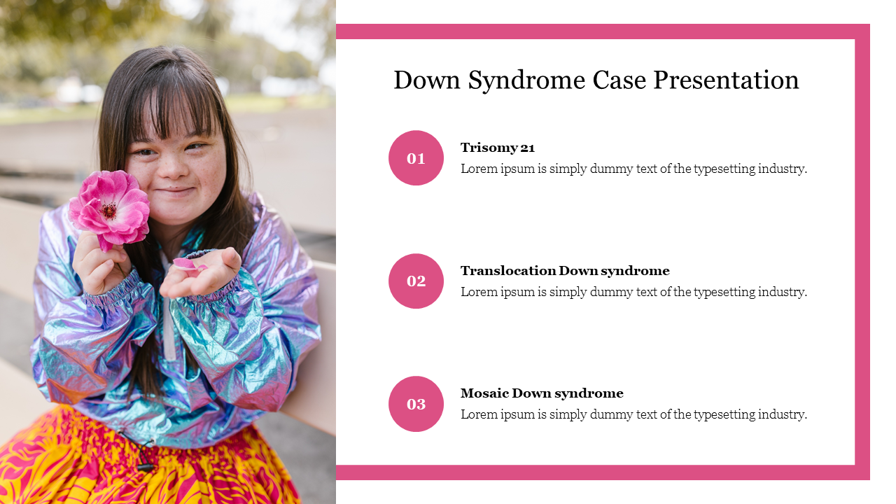 Down Syndrome Case Presentation PPT