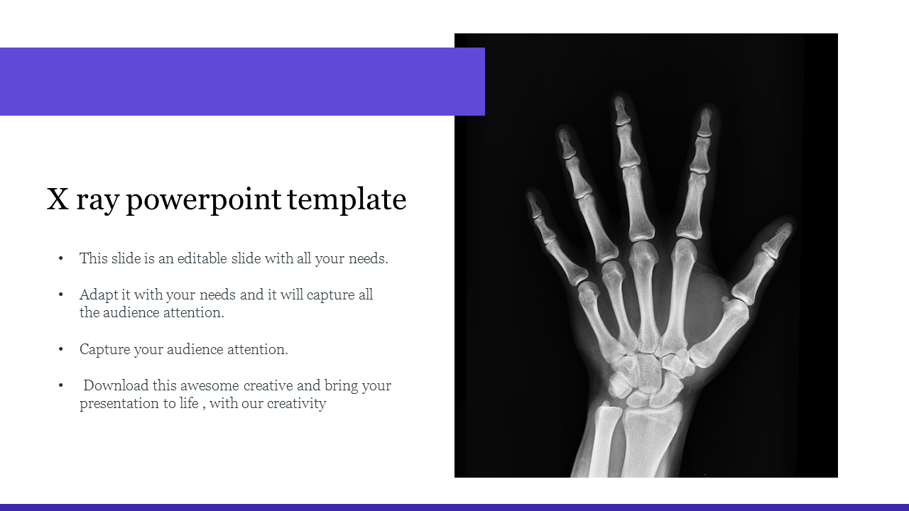 Creative X Ray Powerpoint Template Regarding Radiology Powerpoint Template