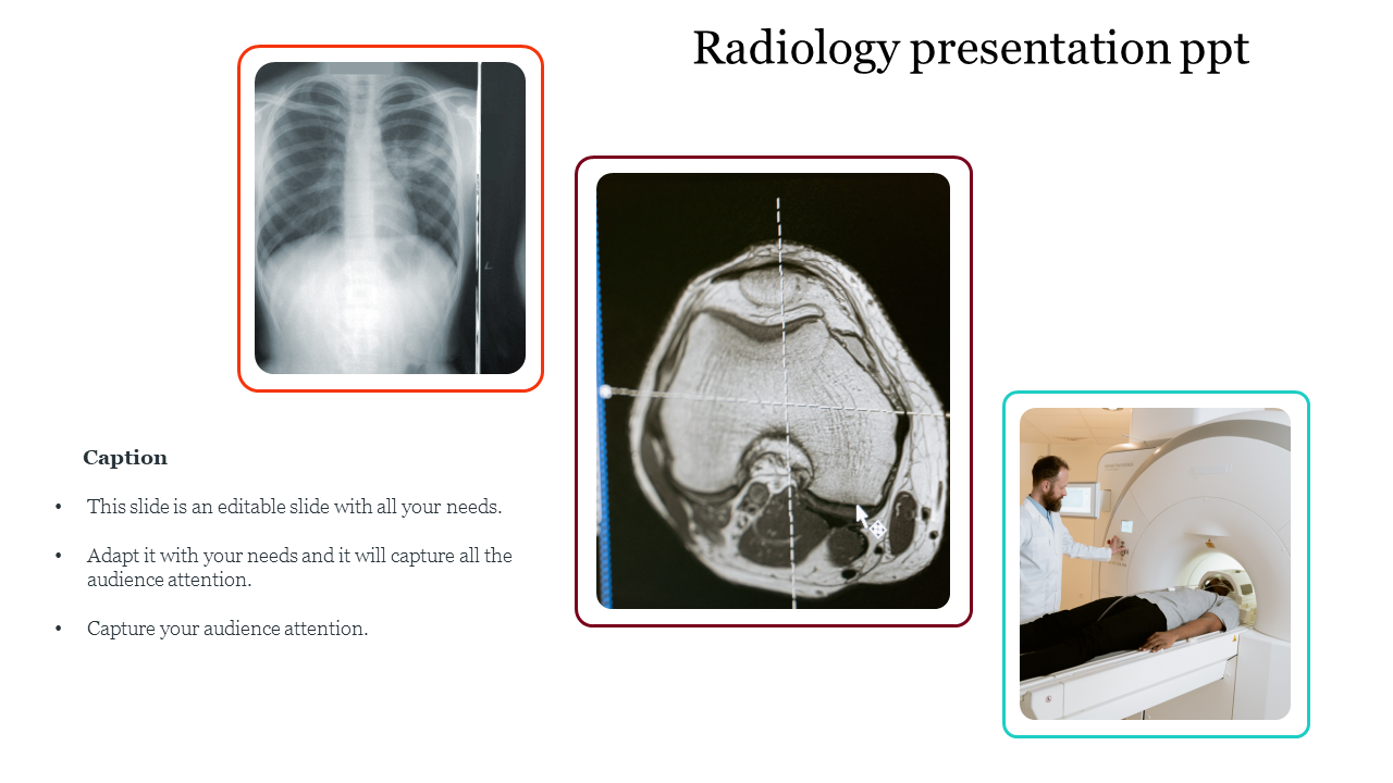 Free Radiology Presentation PPT Slide With Regard To Radiology Powerpoint Template