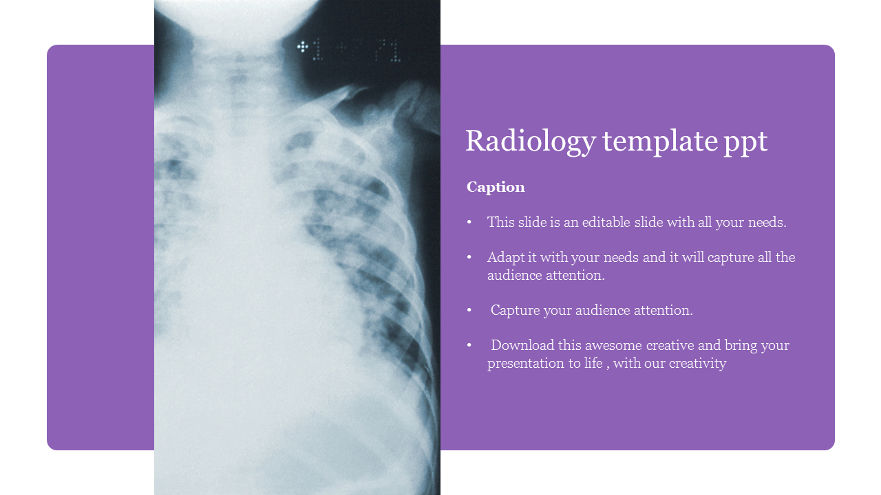 Creative Radiology Template PPT For Radiology Powerpoint Template