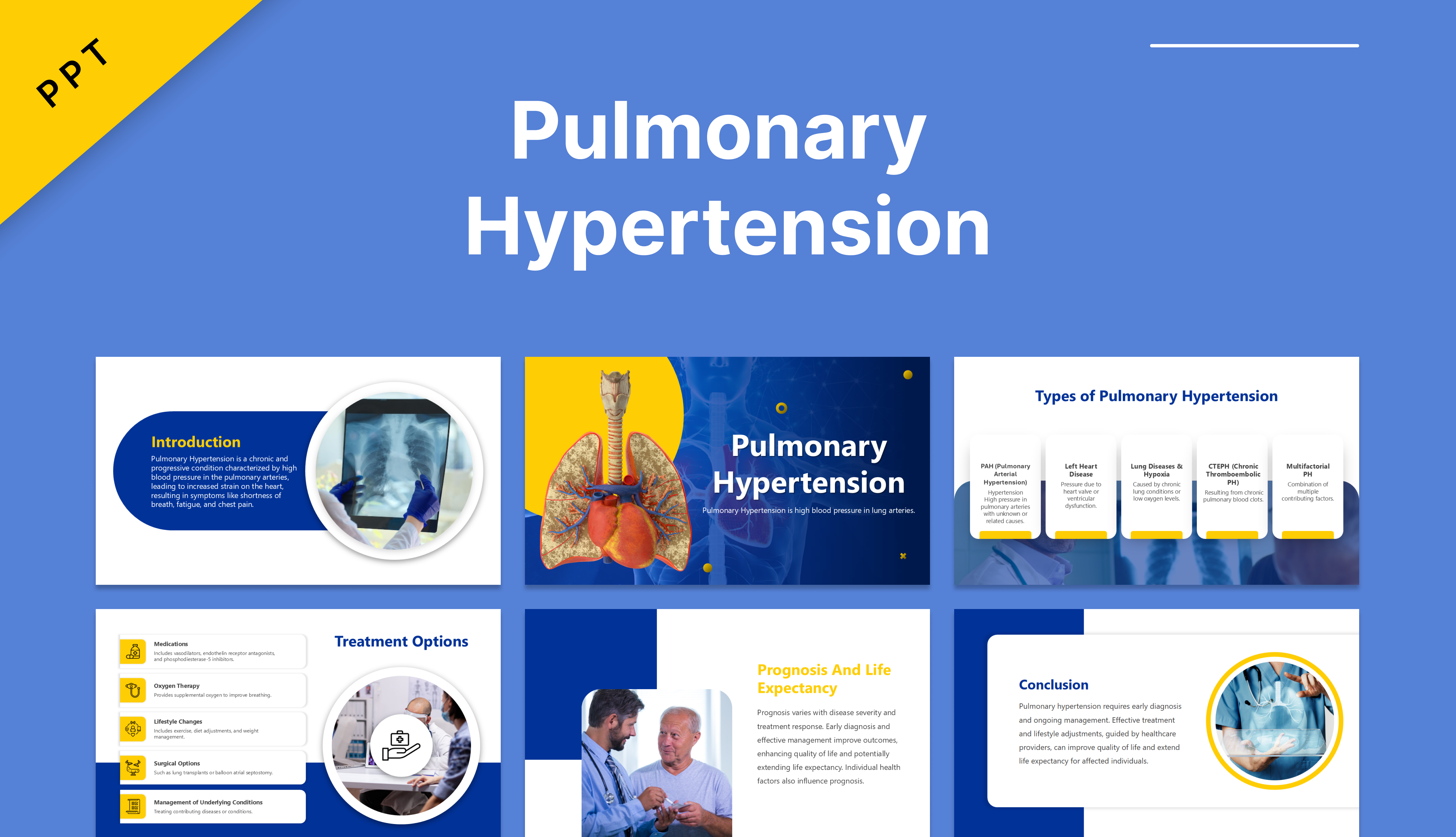 Pulmonary Hypertension slide 1