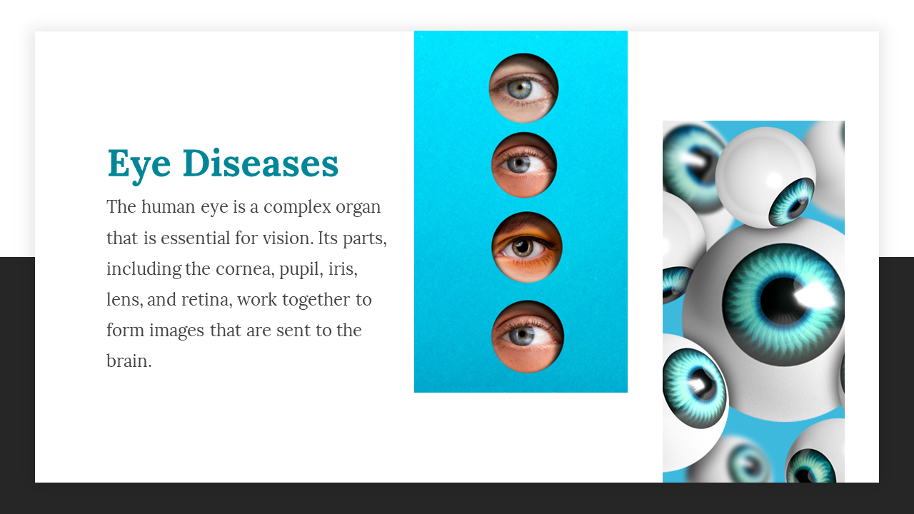 An infographic displaying different eye conditions, with various close up eye images on a blue background.