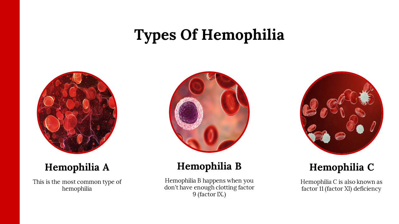 400235-world-haemophilia-day-03