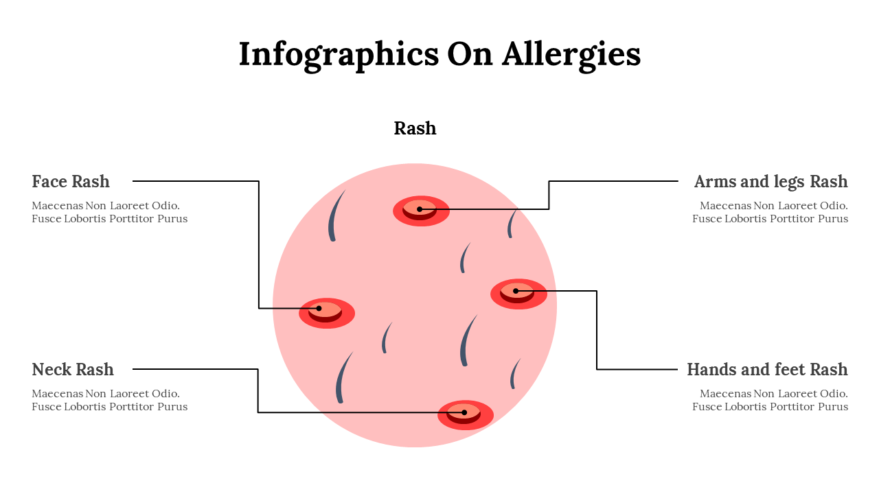 400350-infographics-on-allergies-10