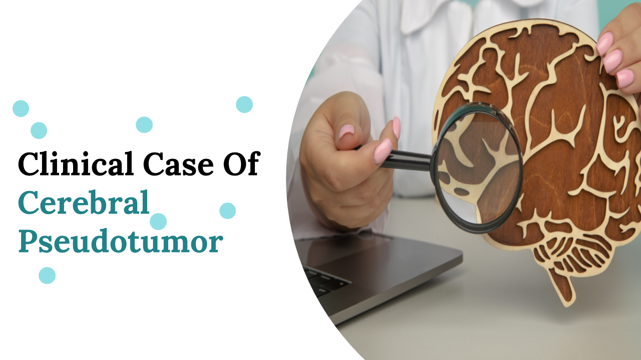 Clinical Case Of Cerebral Pseudotumor PPT and Google Slides