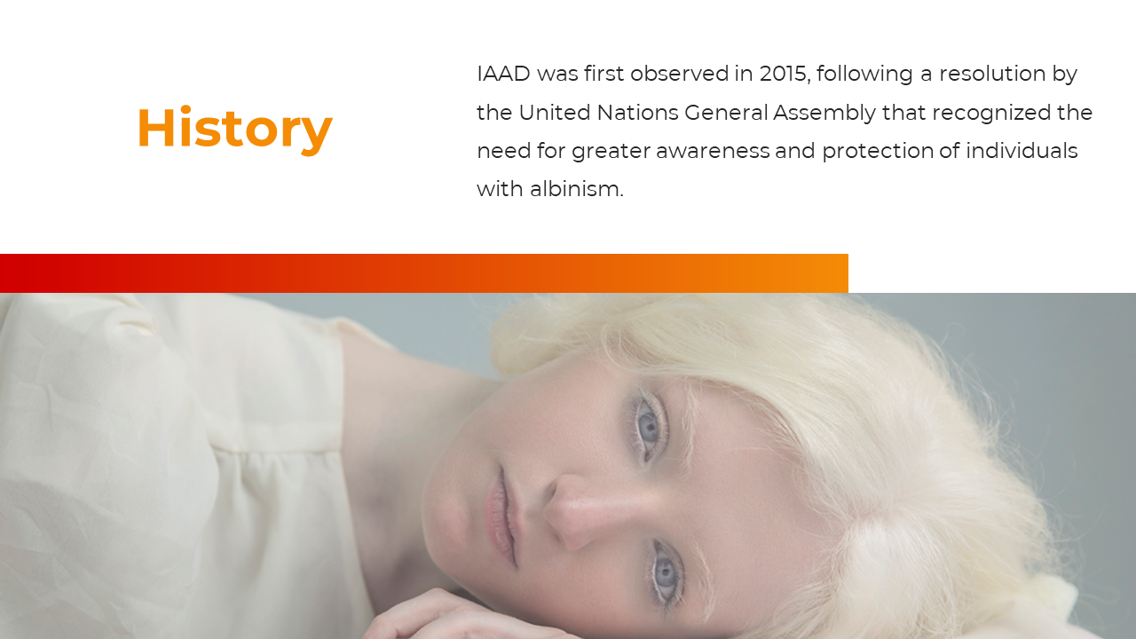 300396-international-albinism-awareness-day-03