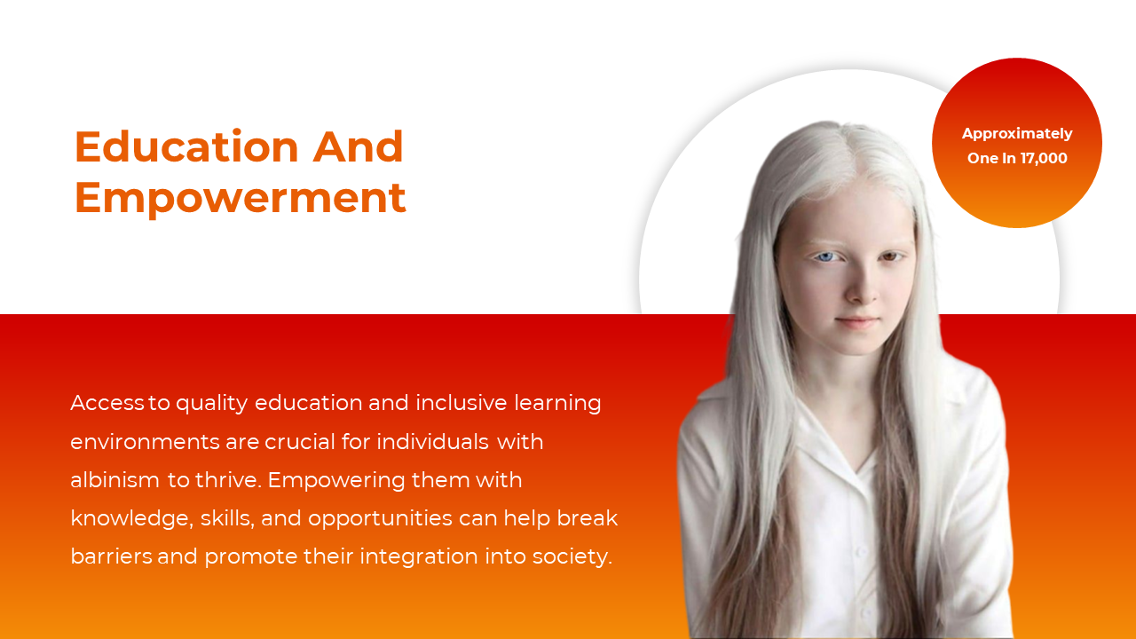 300396-international-albinism-awareness-day-10