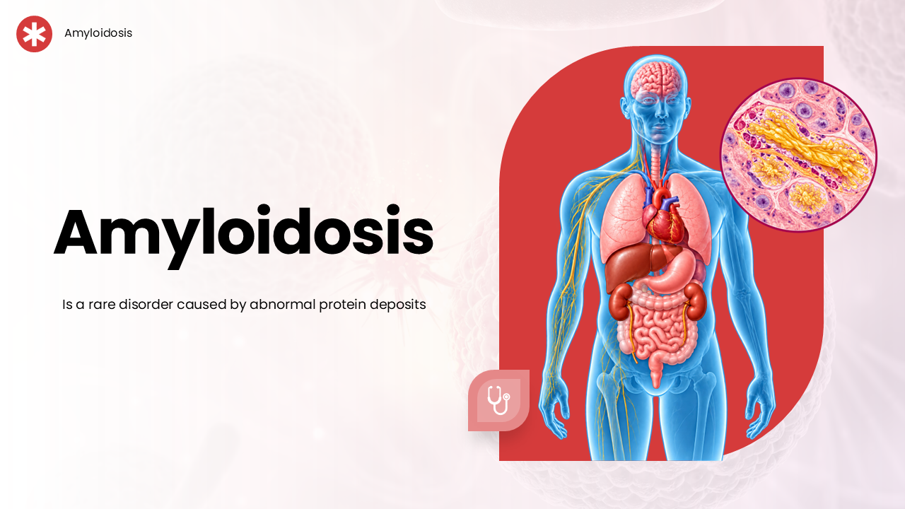 The Amyloidosis PPT Presentation And Canva Template