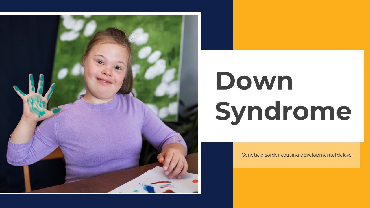 Down Syndrome PowerPoint Presentation