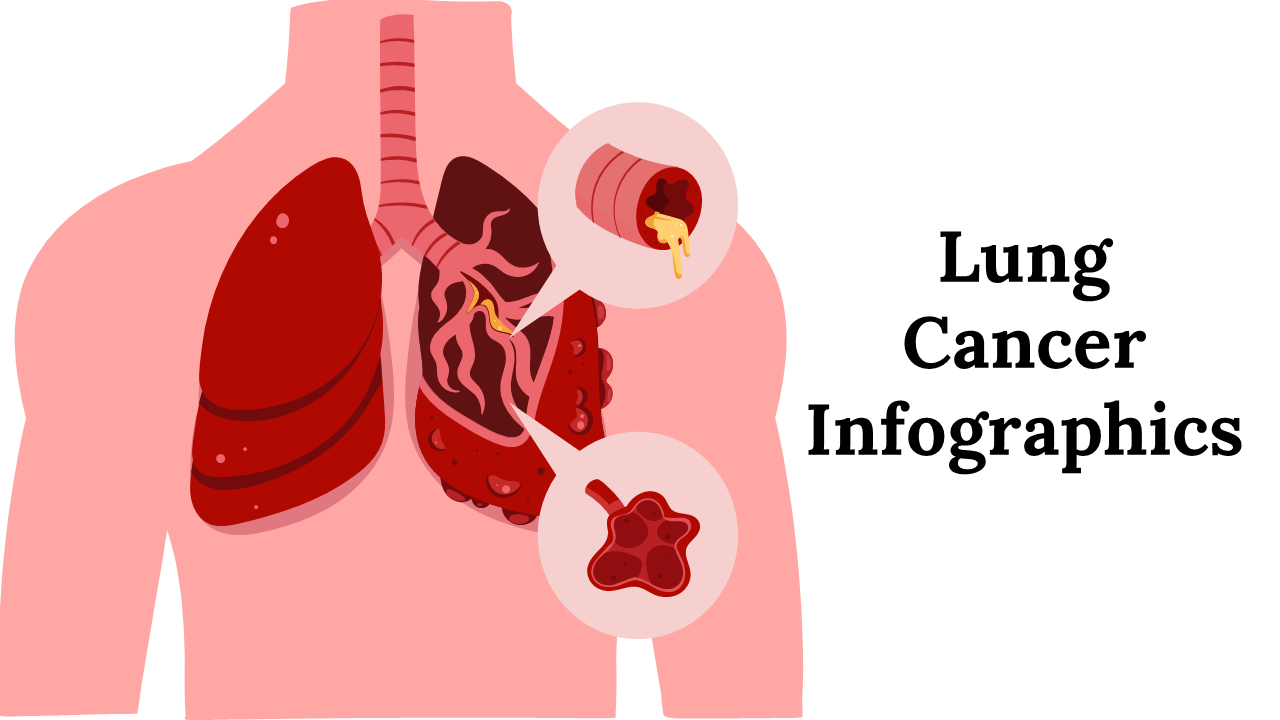 Lung Cancer Infographics