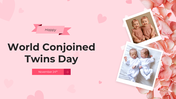 101587-world-conjoined-twins-day-01
