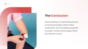 401582-wound-healing-process-10