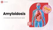 Amyloidosis overview showing body organs, protein deposits, types, causes, symptoms, diagnosis, treatment and complications. - slide 1