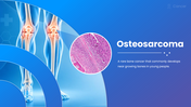 Osteosarcoma overview showing knee bones, tumor tissue, causes, symptoms, diagnosis, staging, treatment and prognosis. - slide 1