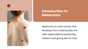 Melanoma overview showing a skin lesion, causes, risk factors, types, symptoms, diagnosis, treatment and prevention. - slide 2