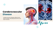 Cerebrovascular Disease presentation  showing causes, symptoms, diagnosis, treatment, complications, and recovery. - slide 1
