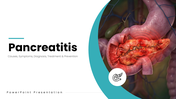 Pancreatitis with pancreas anatomy, teal accents, medical illustrations, text holders and infographic shapes. - slide 1