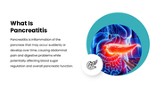 Pancreatitis with pancreas anatomy, teal accents, medical illustrations, text holders and infographic shapes. - slide 2