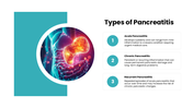 Pancreatitis with pancreas anatomy, teal accents, medical illustrations, text holders and infographic shapes. - slide 4