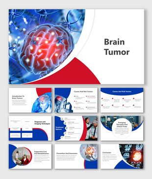 Alt: Pulmonary Hypertension presentation slide deck featuring a detailed 3D anatomical illustration of the heart and lungs on a blue and yellow background.