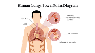 Illustration of human respiratory systemwith labeled anatomy and highlighting healthy versus inflamed bronchial structures.