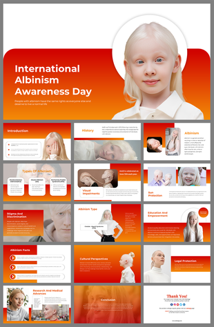 International Albinism Awareness day slides featuring informative slides on albinism, its history, and cultural perspectives.