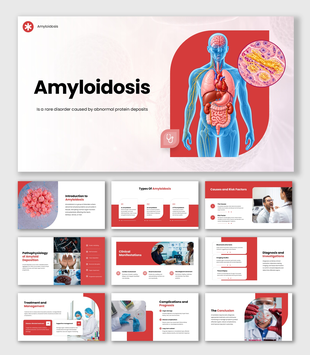 Amyloidosis overview showing body organs, protein deposits, types, causes, symptoms, diagnosis, treatment and complications.