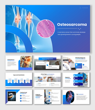 Osteosarcoma overview showing knee bones, tumor tissue, causes, symptoms, diagnosis, staging, treatment and prognosis.
