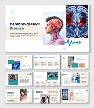 Cerebrovascular Disease presentation  showing causes, symptoms, diagnosis, treatment, complications, and recovery.