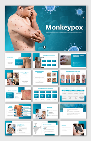 A pack of slides features a man with a visible Monkeypox rash on his arm and torso, illustrating the symptoms of the disease.
