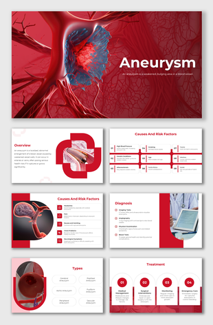 Aneurysm slide deck featuring red anatomical imagery, icon-labeled causes, diagnostic visuals, and treatment step graphics.