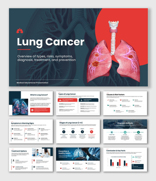 Lung Cancer slide with lung graphic, tumor highlights, teal red shapes, and structured text sections.