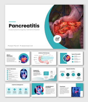 Pancreatitis with pancreas anatomy, teal accents, medical illustrations, text holders and infographic shapes.