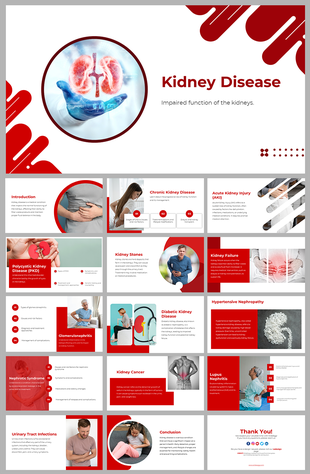 Red and white themed slide deck covering topics like kidney stones, chronic disease, and treatment options.