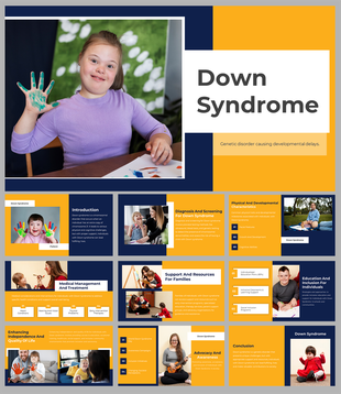 Down syndrome slides with yellow and navy layout, discussing screening, medical care, and educational support.