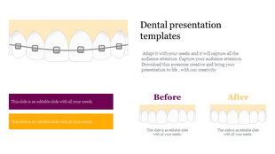 A dental slide displaying a graphic of teeth with braces, featuring text boxes and two sections.