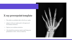 X-ray image of a hand on the right, with text listed on the left, bordered by purple bars.